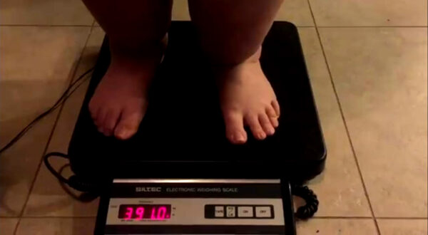 GLP-1 Rapid Weight Loss Without Exercise Leads to Regain